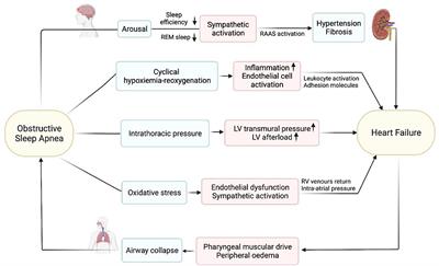 Management of Obstructive Sleep Apnea in Patients With Heart Failure